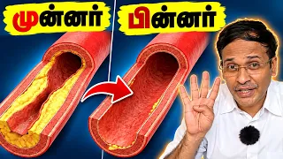 இதய அடைப்பை தடுக்கும் No.1 உணவு — ஆராய்ச்சி ஆதாரத்துடன்! | Tamil Health Doctor Karthikeyan