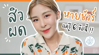 ทำไมสิวผดถึงขึ้นตอนเย็นแล้วหายตอนเช้า