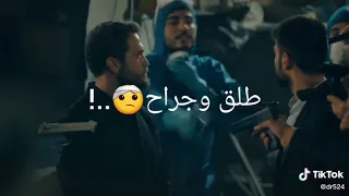 شدو السلاح طلق وجراح    حالات واتس أب الحفرة       دندنها