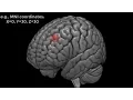 Introduction to Region of Interest ROI Analysis in fMRI