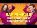 Ear Pimples What They Are How to Treat and Prevent Them