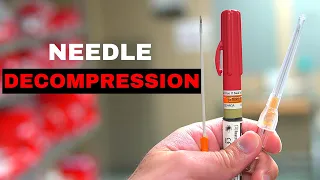 How To Chest Needle Decompression