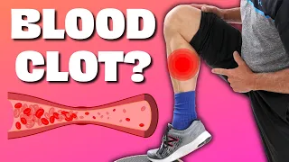 Is Your Calf Pain a Blood Clot Do Homan s Test and Find Out