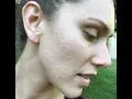 Why I Wash My Face With Dr Bronners Castile Soap Acne Prone Skin PH Acid Oil etc