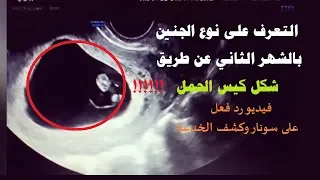 تحديد نوع الجنين بالشهر الثاني عن طريق شكل كيس الحمل    فيديو رد فعل على سونار وكشف الخدعة دندنها