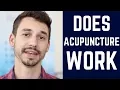 Does Acupuncture Actually Work