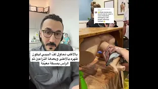 توليد بيبي مقعدي        دندنها