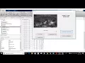 kidney stone in matlab code
