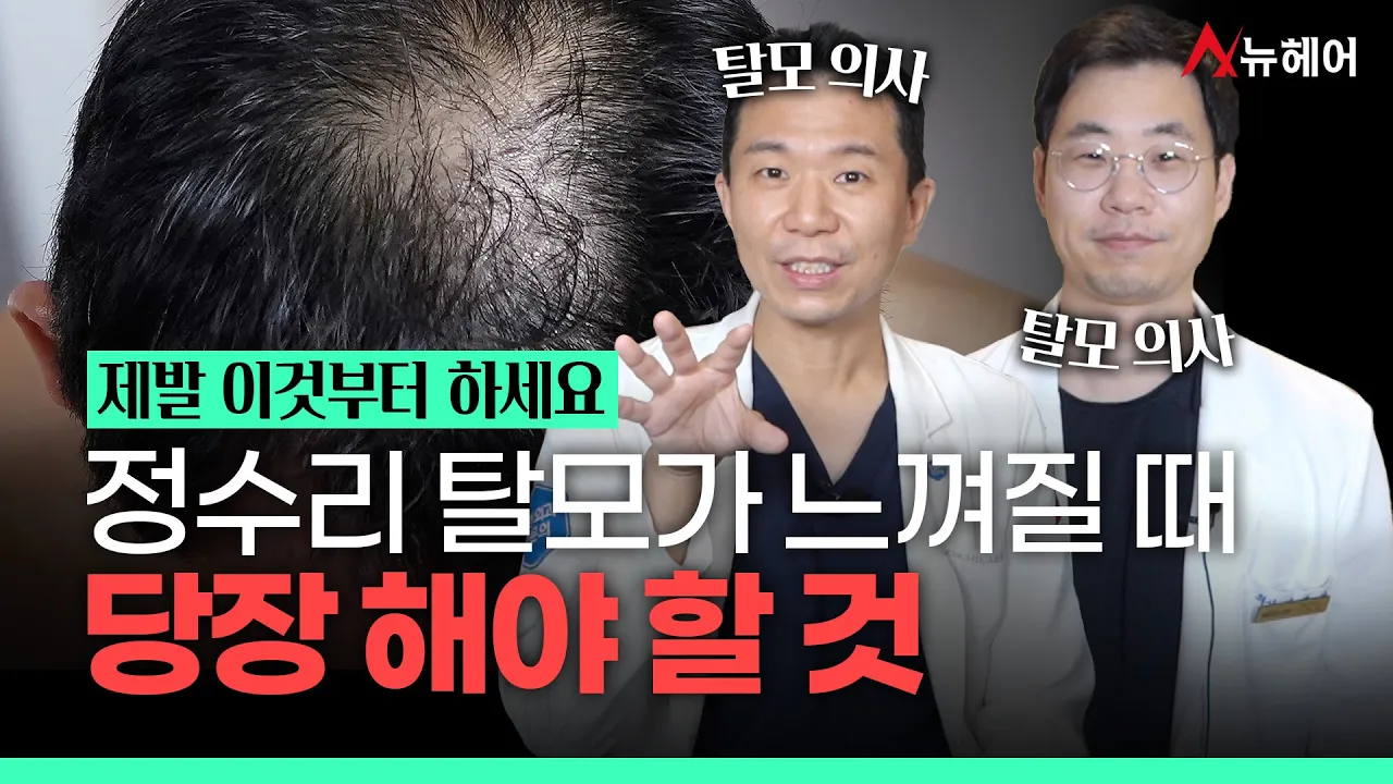 정수리 탈모가 느껴질 때 당장 해야 할 것ㅣ뉴헤어