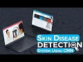 Skin Disease Detection System Using CNN Machine Learning Projects