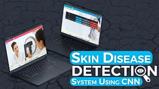 Skin Disease Detection System Using CNN Machine Learning Projects