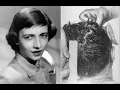 Dr Jackie Hunt s Reaction to JFK Autopsy Photo 1979