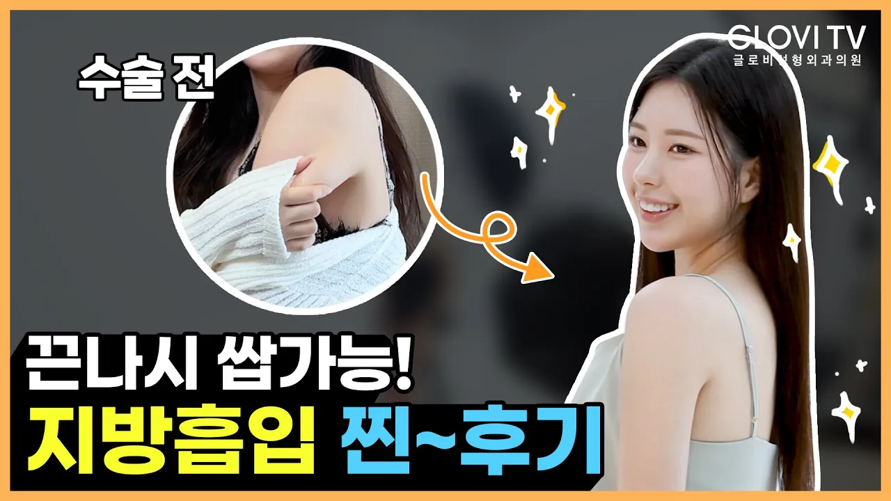 끈나시 쌉가능! 미스코리아👑 지방흡입 찐후기!