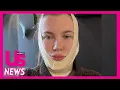 Ireland Baldwin Defends Her Decision to Get Plastic Surgery