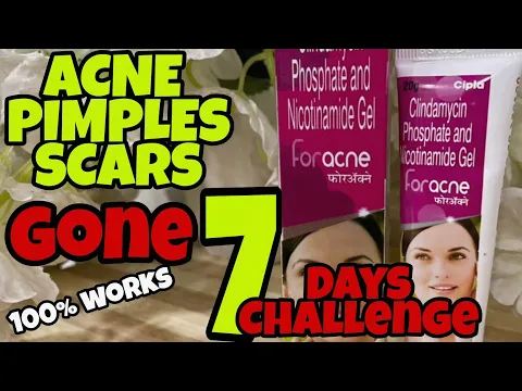 Download MP3 Clyndamicin \u0026 Nicotinamide Gel for Acne \u0026 Scars | Remove Acne/Pimples completely | Foracne By Cipla