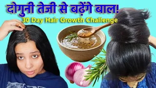 उगेंगे दोगुनी तेजी से बाल | Stop Hair Fall - 30 Days Summer Hair Growth Challenge