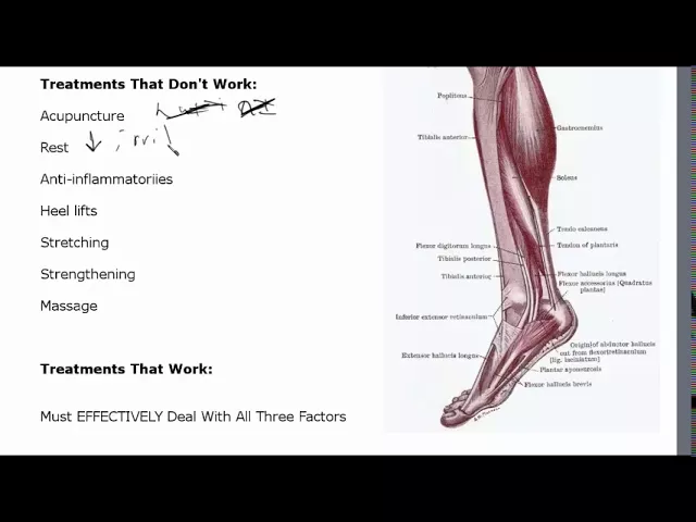 Achilles Tendonitis Treatment
