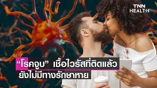 โรคจูบเกิดจากเชื้อไวรัสชนิดใด และแพร่กระจายผ่านทางใด