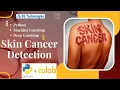 Deep Learning Techniques for Skin Cancer Detection python colab