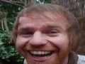 WORLDS BIGGEST FOREHEAD
