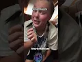 JoJo Siwa drunkenly says she s not OK after being punched in the eye on her 21st birt ay
