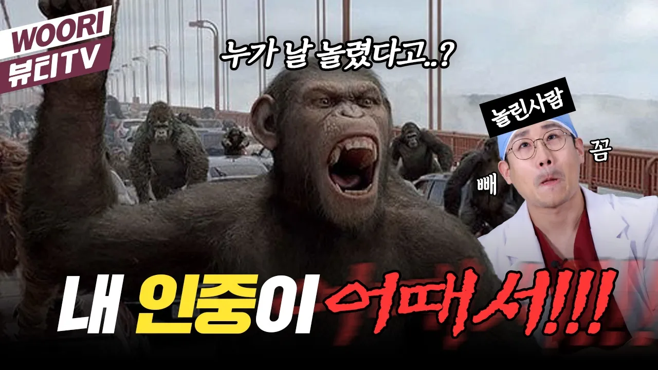 절대 잊으면 안되는 중안면부의 중요성 ㅣ 인중축소술