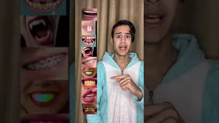 ترند التيك توك رهيب وجديد ترند اختيار الاسنان 