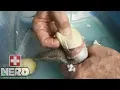 REVISITING OUR EGG BOUND BLOOD PYTHON - ANTIBIOTICS MORE EGGS