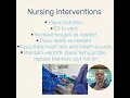 NRP part 1 The initial steps