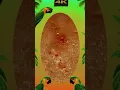 Blackheads Removal Acne Treatment and Very Satisfying Satisfying Pimple pop