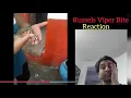 Russels Viper BITE