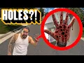 IF YOU EVER FIND THESE HOLES ON YOUR HANDS RUN YOU RE INFECTED