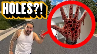 IF YOU EVER FIND THESE HOLES ON YOUR HANDS RUN YOU RE INFECTED