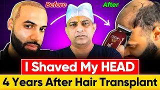 I Shaved My HEAD BALD 4 Years After Hair Transplant | Surgeon Reacts