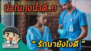 ทำไมการผ่าตัดนิ่วในถุงน้ำดีที่ไม่มีอาการถึงไม่แนะนำ?