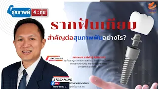 การรักษาฟันด้วยการใส่รากฟันเทียมใช้เวลานานแค่ไหน