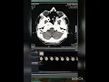 C T Brain Plain Patient Age - 26year Unremarkable Study C T Brain images