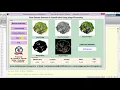 Plant Disease Detection and Classification Using Image Processing Matlab Code