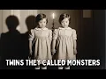 Download Lagu (1857 – Vienna) The Erased Case of the Keller Twins | Children Science Classified as Monsters