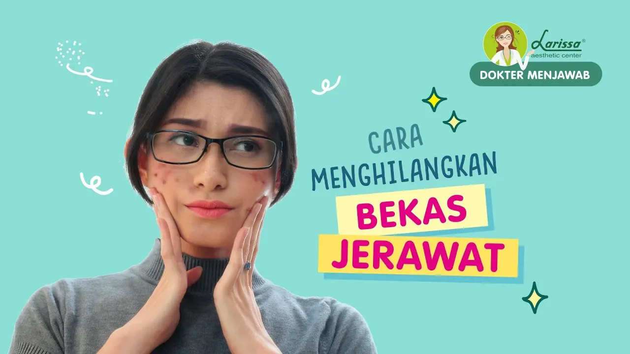 Cara Memutihkan Wajah & Mengurangi Flek Hitam Dengan Produk Baru Larissa Sakura Series . NEW PRODUCT. 