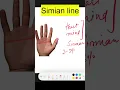 Simian line