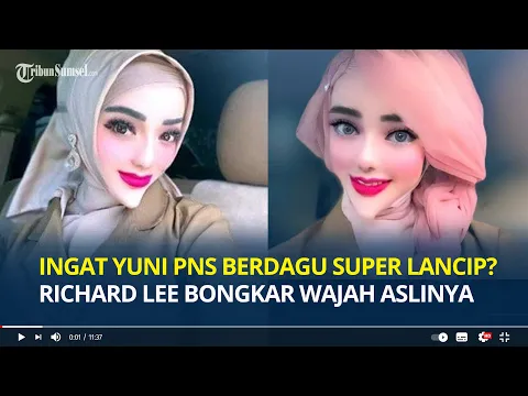 Download MP3 Ingat Yuni Jasmine PNS Berdagu Super Lancip? Richard Lee Bongkar Wajah Aslinya, Ternyata Seperti Ini