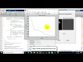 Liver Tumor detection and Classification using Matlab