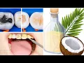 Download Lagu Tips Terbaik Untuk Menghilangkan Karang Gigi Tanpa Harus Ke Dokter\