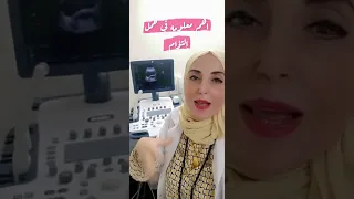 أهم معلومة في حمل التوأم د دعاء مطاوع 