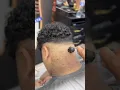 Removing the blackhead from the back of the neck