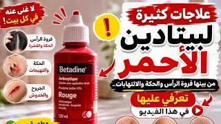 علاجات كثيرة ل          الاحمر من بينها فروة الرأس و الحكة و الالتهابات   تعرفي عليعا في هذا الفيديو دندنها