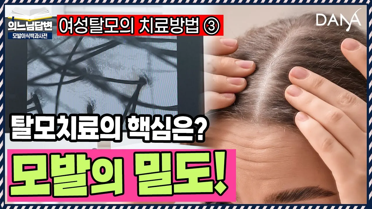 의느님답변📂여성형 탈모 치료의 핵심은? 모발의 밀도!ㅣ여성탈모의 치료방법③ㅣ다나성형외과(DANA)ㅣ모발이식ㅣ헤어라인교정ㅣ두피문신ㅣ탈모치료