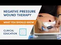 Negative Pressure Wound Therapy Clinical Education