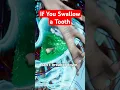 If You Swallow a Tooth What Happens